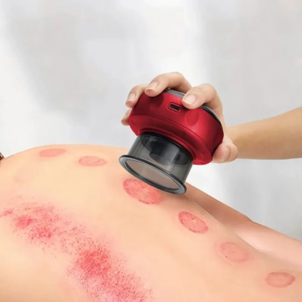 Cupping Therapy Device - Image 5